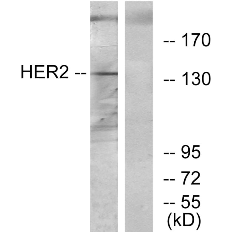 Western Blot - Anti-HER2 Antibody (C12903) - Antibodies.com