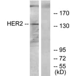 Western Blot - Anti-HER2 Antibody (C12903) - Antibodies.com