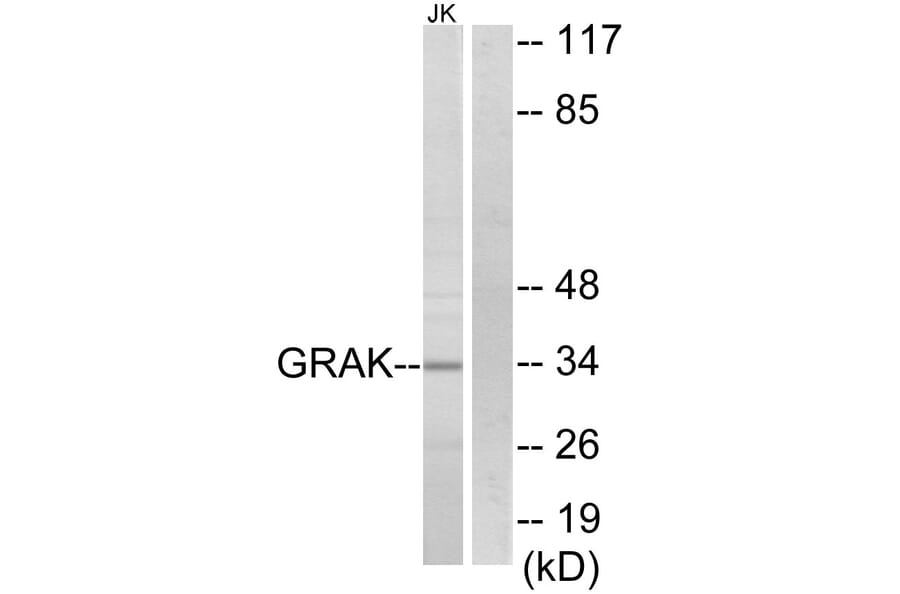 Western Blot - Anti-GRAK Antibody (C13060) - Antibodies.com