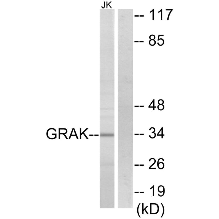 Western Blot - Anti-GRAK Antibody (C13060) - Antibodies.com