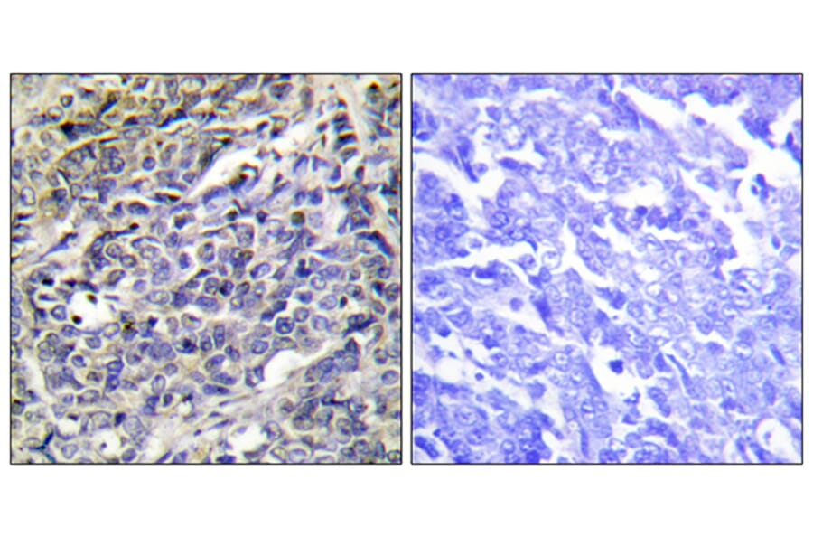 Immunohistochemistry - Anti-GRAK Antibody (C13060) - Antibodies.com