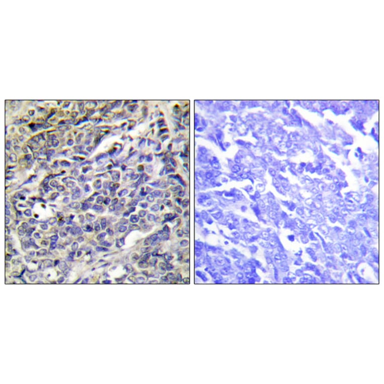 Immunohistochemistry - Anti-GRAK Antibody (C13060) - Antibodies.com
