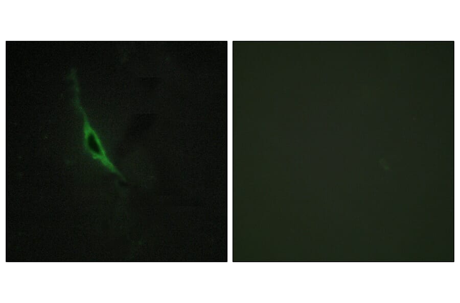 Immunofluorescence - Anti-GRAK Antibody (C13060) - Antibodies.com