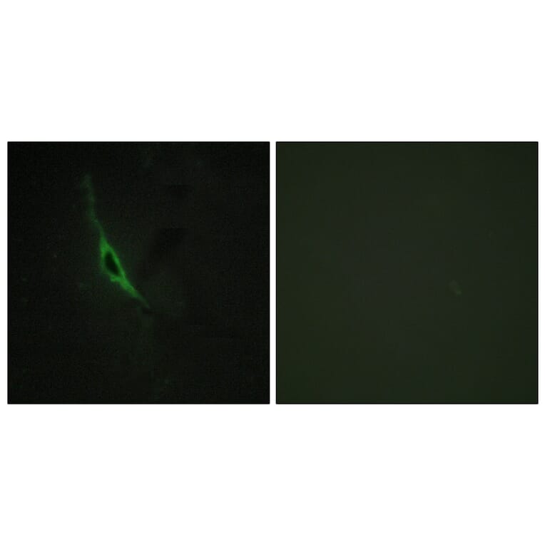 Immunofluorescence - Anti-GRAK Antibody (C13060) - Antibodies.com