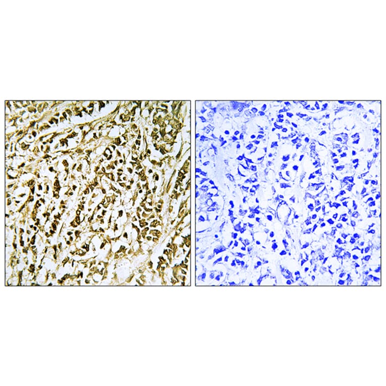 Immunohistochemistry - Anti-FEN1 Antibody (C10585) - Antibodies.com