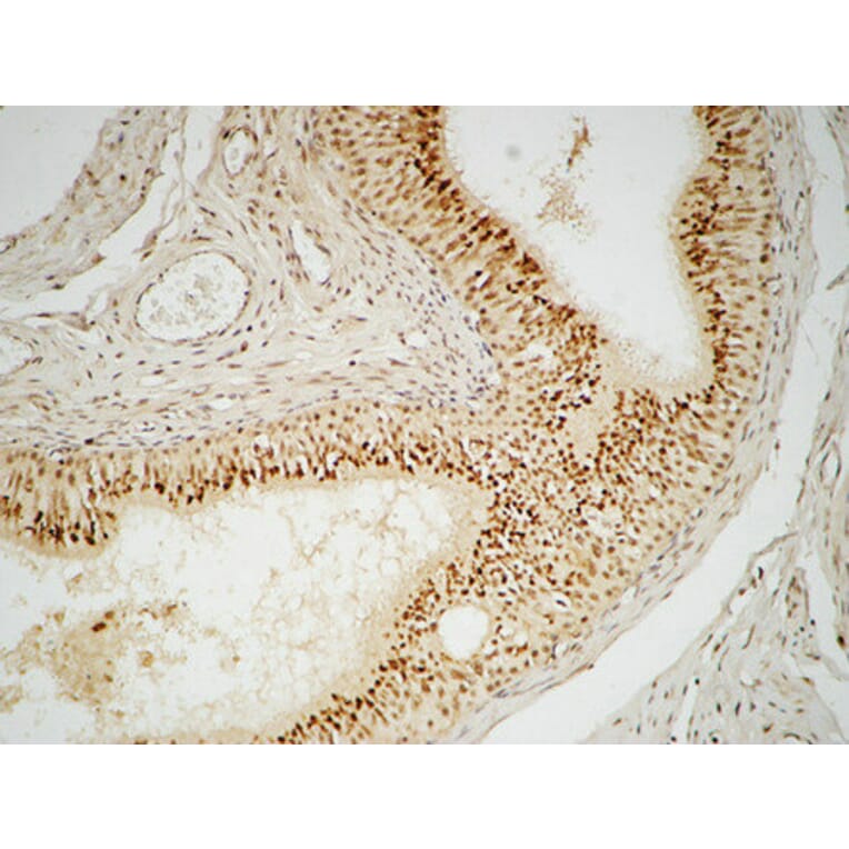 Immunohistochemistry - Anti-FEN1 Antibody (C10585) - Antibodies.com
