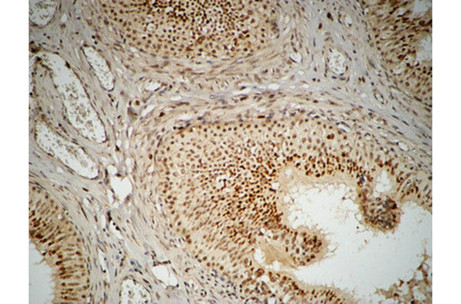 Immunohistochemistry - Anti-FEN1 Antibody (C10585) - Antibodies.com