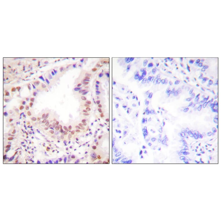 Immunohistochemistry - Anti-ETS1 Antibody (B0478) - Antibodies.com
