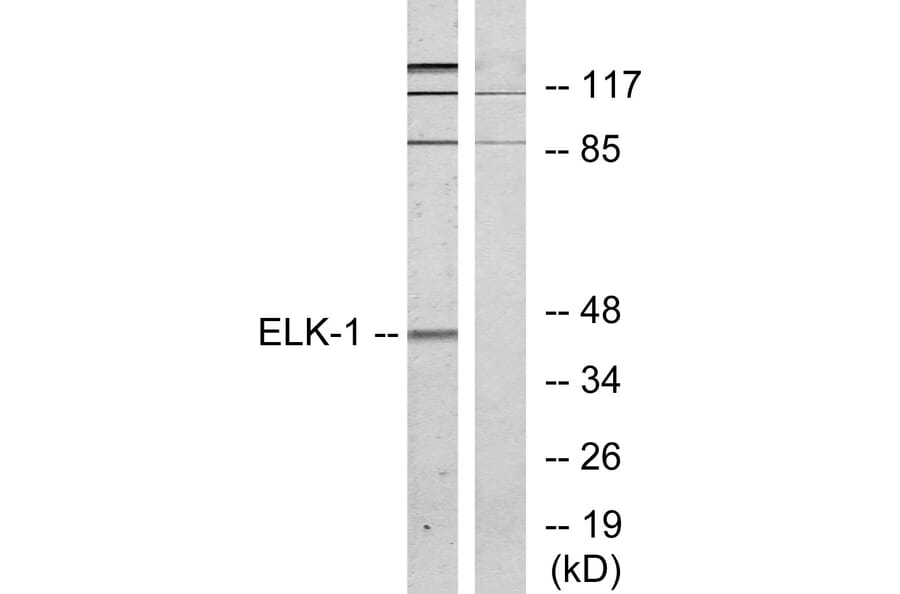 Western Blot - Anti-Elk1 Antibody (B7069) - Antibodies.com