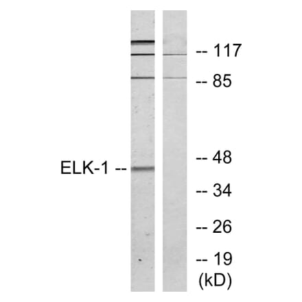 Western Blot - Anti-Elk1 Antibody (B7069) - Antibodies.com