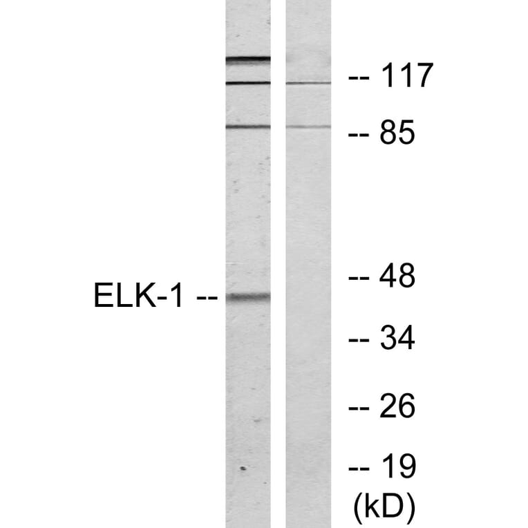 Western Blot - Anti-Elk1 Antibody (B7069) - Antibodies.com