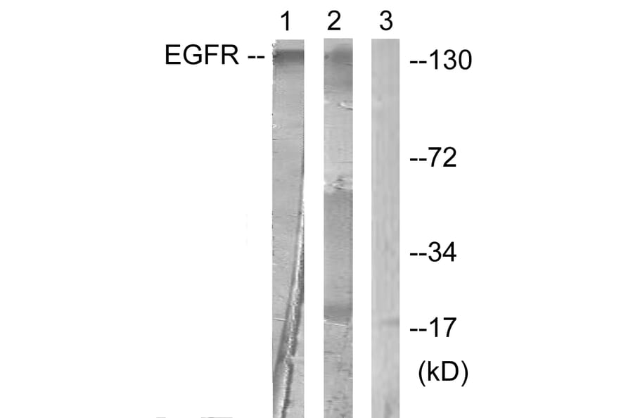 Western Blot - Anti-EGFR Antibody (B0475) - Antibodies.com