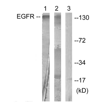 Western Blot - Anti-EGFR Antibody (B0475) - Antibodies.com
