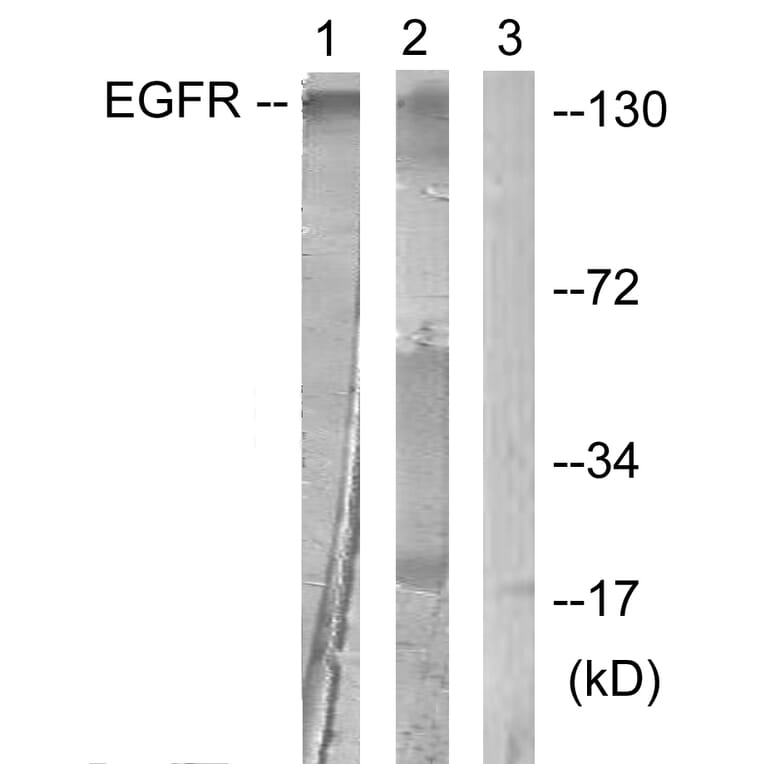 Western Blot - Anti-EGFR Antibody (B0475) - Antibodies.com