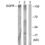 Western Blot - Anti-EGFR Antibody (B0475) - Antibodies.com