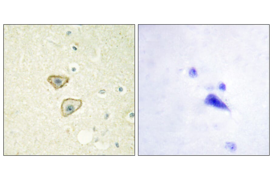 Immunohistochemistry - Anti-EGFR Antibody (B0475) - Antibodies.com