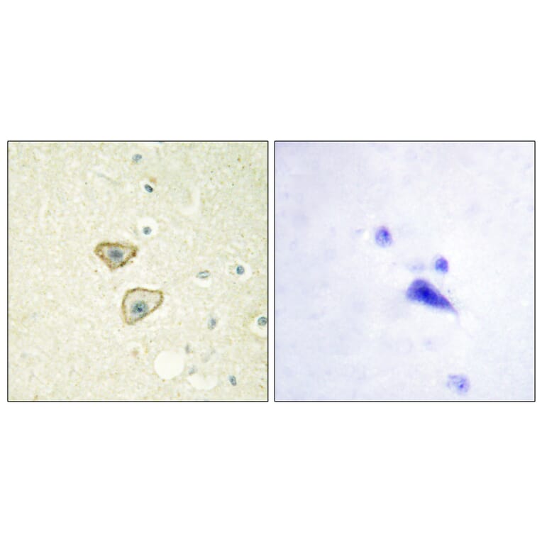 Immunohistochemistry - Anti-EGFR Antibody (B0475) - Antibodies.com