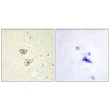Immunohistochemistry - Anti-EGFR Antibody (B0475) - Antibodies.com