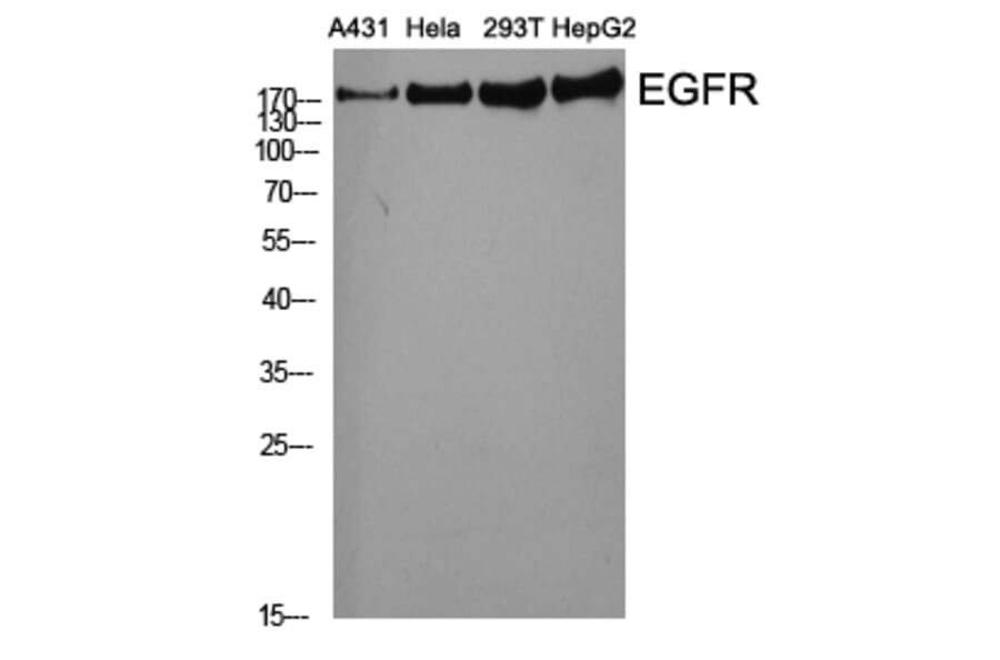 Western Blot - Anti-EGFR Antibody (B0475) - Antibodies.com