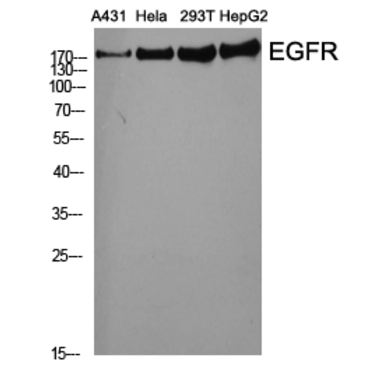 Western Blot - Anti-EGFR Antibody (B0475) - Antibodies.com