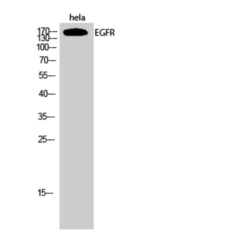 Western Blot - Anti-EGFR Antibody (B0475) - Antibodies.com