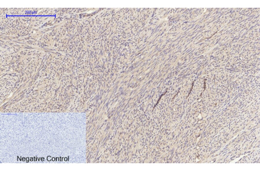 Immunohistochemistry - Anti-EGFR Antibody (B0475) - Antibodies.com