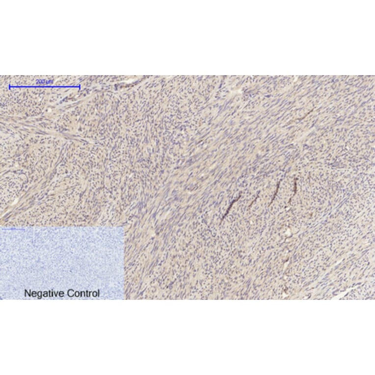 Immunohistochemistry - Anti-EGFR Antibody (B0475) - Antibodies.com