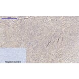Immunohistochemistry - Anti-EGFR Antibody (B0475) - Antibodies.com