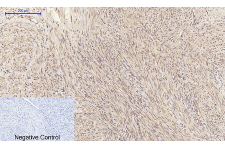 Immunohistochemistry - Anti-EGFR Antibody (B0475) - Antibodies.com