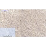 Immunohistochemistry - Anti-EGFR Antibody (B0475) - Antibodies.com