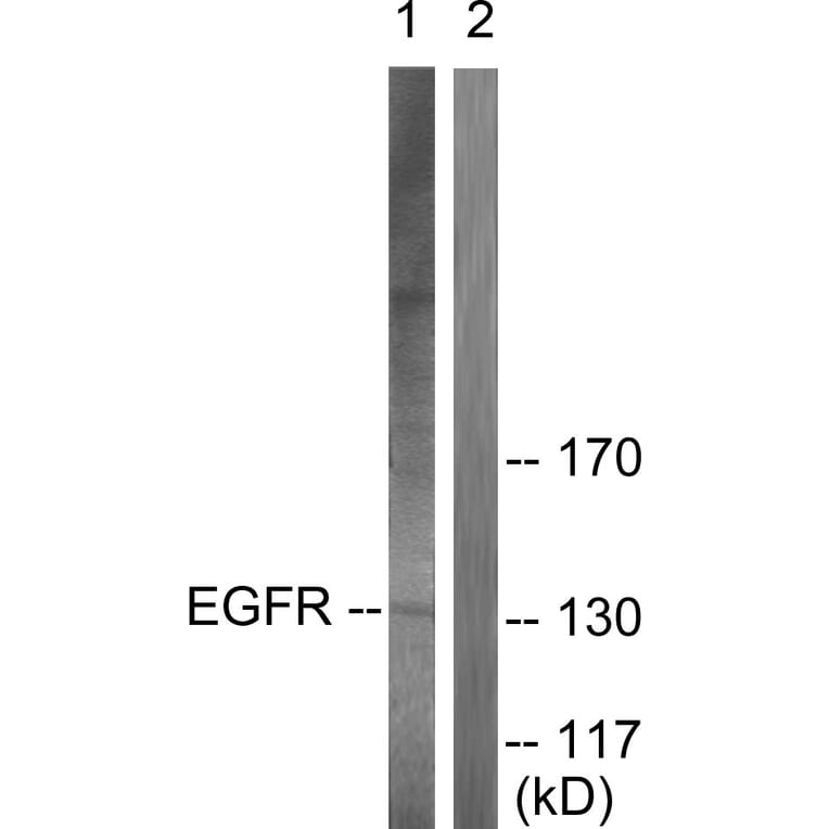 Western Blot - Anti-EGFR Antibody (B0009) - Antibodies.com