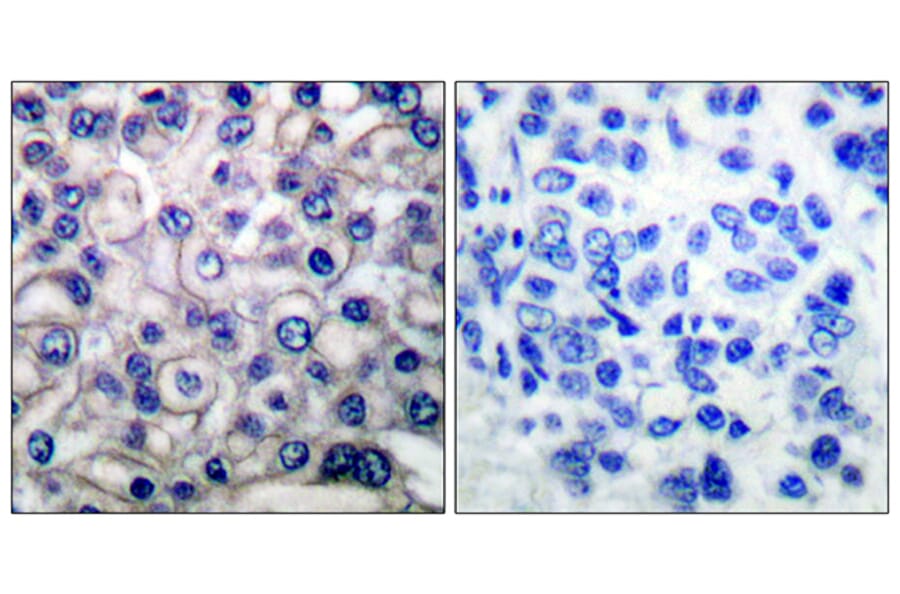 Immunohistochemistry - Anti-EGFR Antibody (B0009) - Antibodies.com