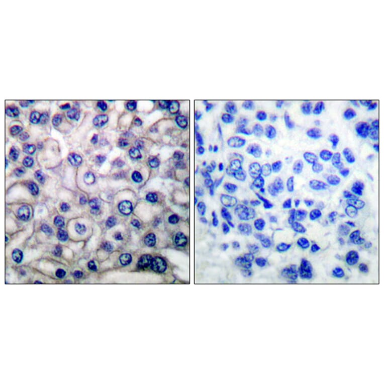 Immunohistochemistry - Anti-EGFR Antibody (B0009) - Antibodies.com