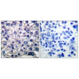 Immunohistochemistry - Anti-EGFR Antibody (B0009) - Antibodies.com