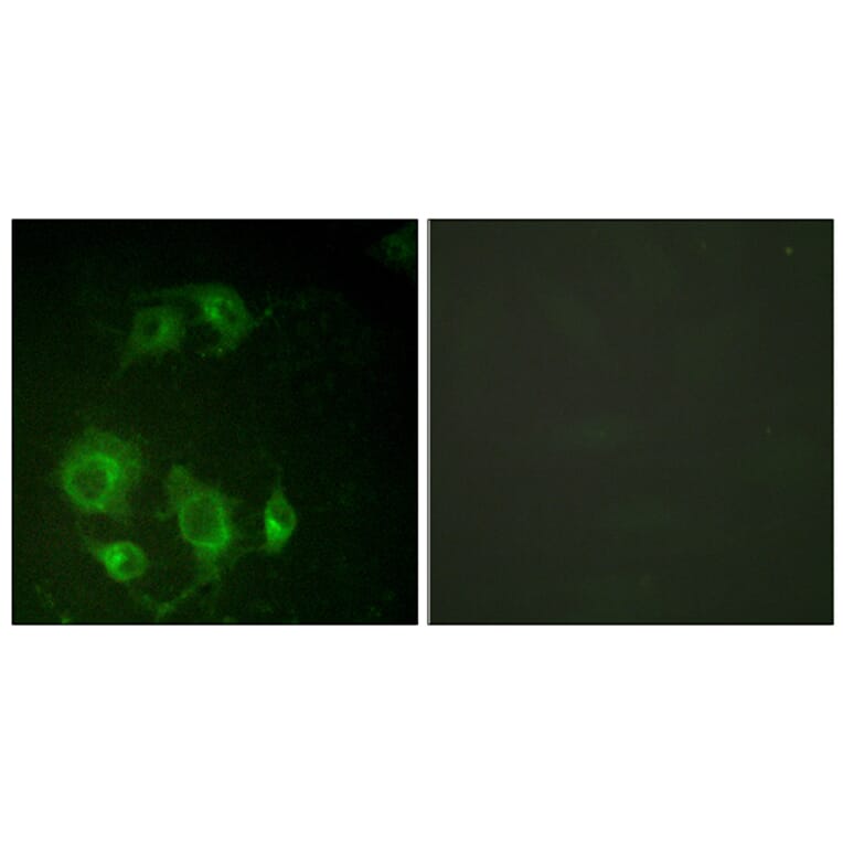 Immunofluorescence - Anti-EGFR Antibody (B0009) - Antibodies.com