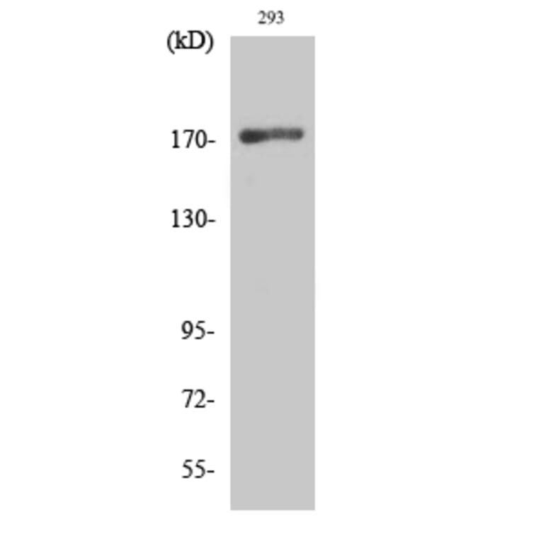 Western Blot - Anti-EGFR Antibody (B0009) - Antibodies.com