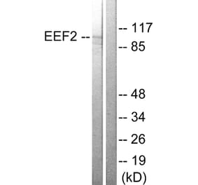Western Blot - Anti-eEF2 Antibody (B0070) - Antibodies.com