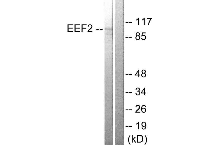 Western Blot - Anti-eEF2 Antibody (B0070) - Antibodies.com