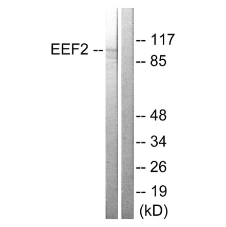 Western Blot - Anti-eEF2 Antibody (B0070) - Antibodies.com