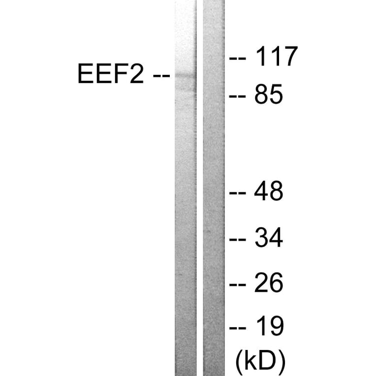 Western Blot - Anti-eEF2 Antibody (B0070) - Antibodies.com