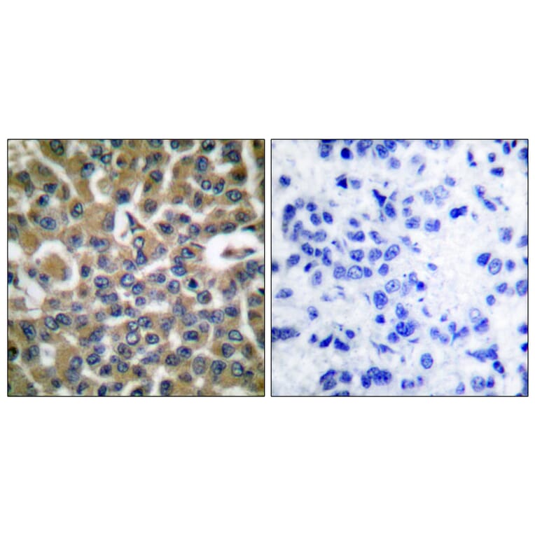 Immunohistochemistry - Anti-eEF2 Antibody (B0070) - Antibodies.com