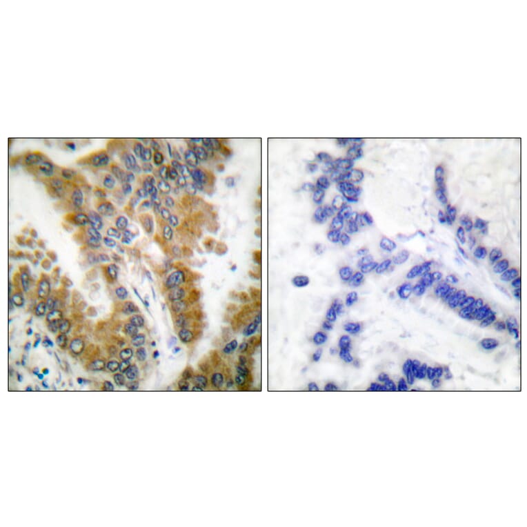 Immunohistochemistry - Anti-CrkL Antibody (B0067) - Antibodies.com
