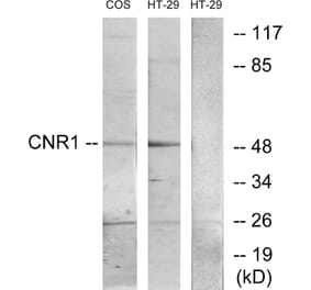 Western Blot - Anti-CNR1 Antibody (G226) - Antibodies.com