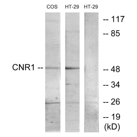 Western Blot - Anti-CNR1 Antibody (G226) - Antibodies.com