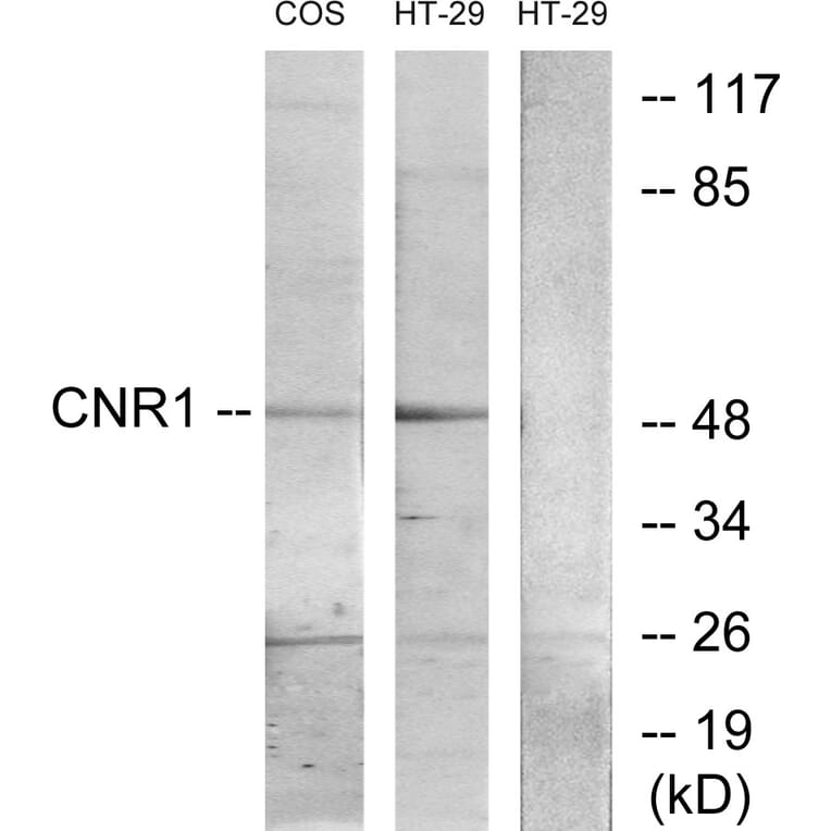 Western Blot - Anti-CNR1 Antibody (G226) - Antibodies.com