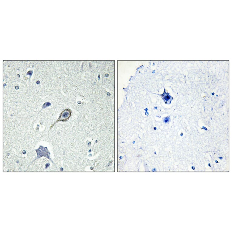 Immunohistochemistry - Anti-CNR1 Antibody (G226) - Antibodies.com