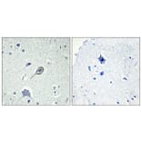 Immunohistochemistry - Anti-CNR1 Antibody (G226) - Antibodies.com