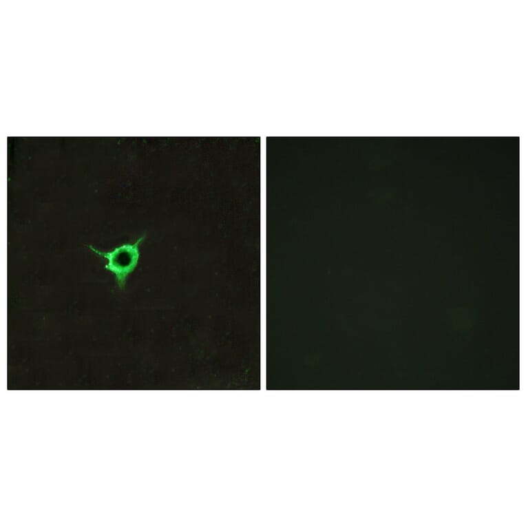 Immunofluorescence - Anti-CNR1 Antibody (G226) - Antibodies.com