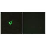 Immunofluorescence - Anti-CNR1 Antibody (G226) - Antibodies.com
