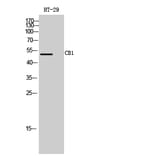 Western Blot - Anti-CNR1 Antibody (G226) - Antibodies.com
